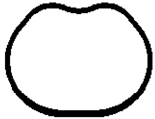 Gasket, intake manifold