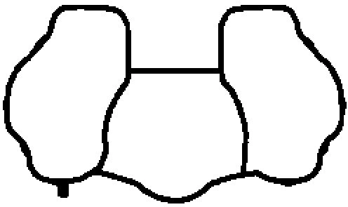 Gasket, intake manifold