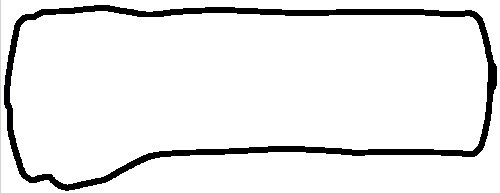 Gasket, cylinder head cover